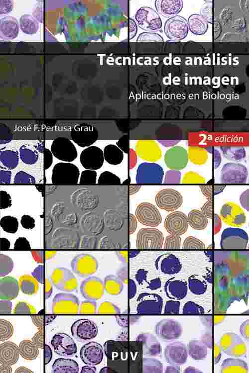 Técnicas de análisis de imagen, (2a ed.)