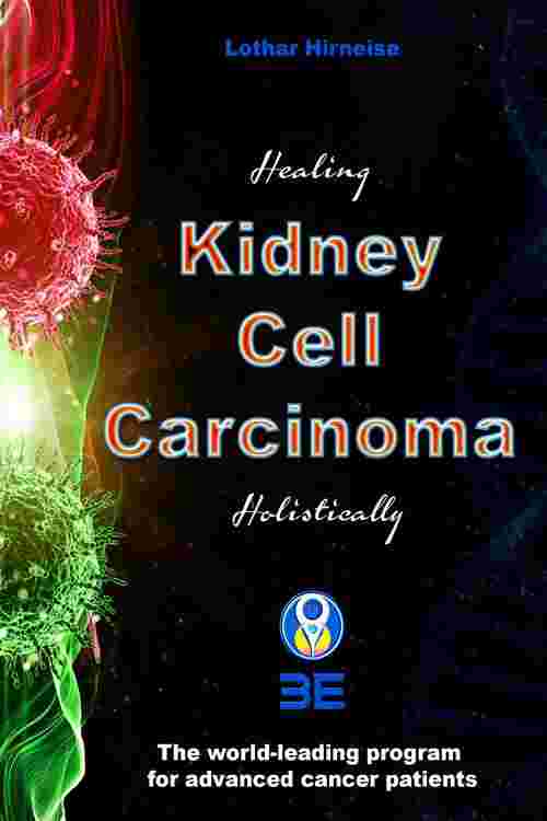 Kidney Cell Carcinoma