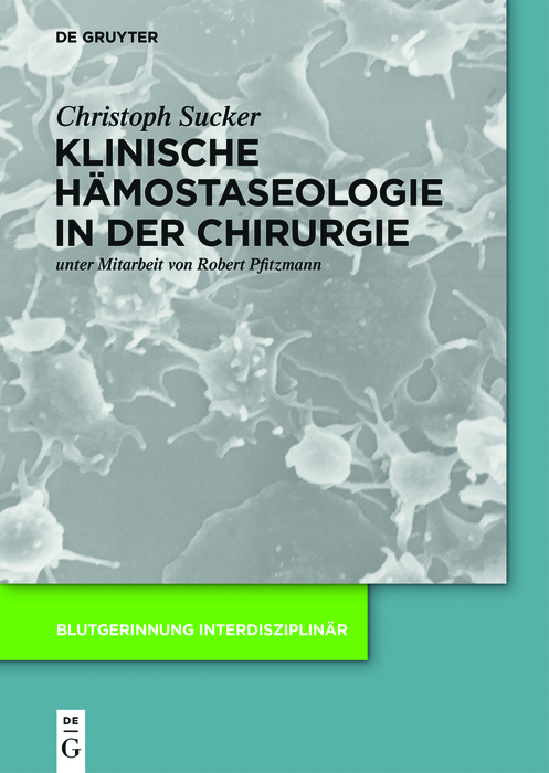 Klinische Hämostaseologie in der Chirurgie - Christoph Sucker