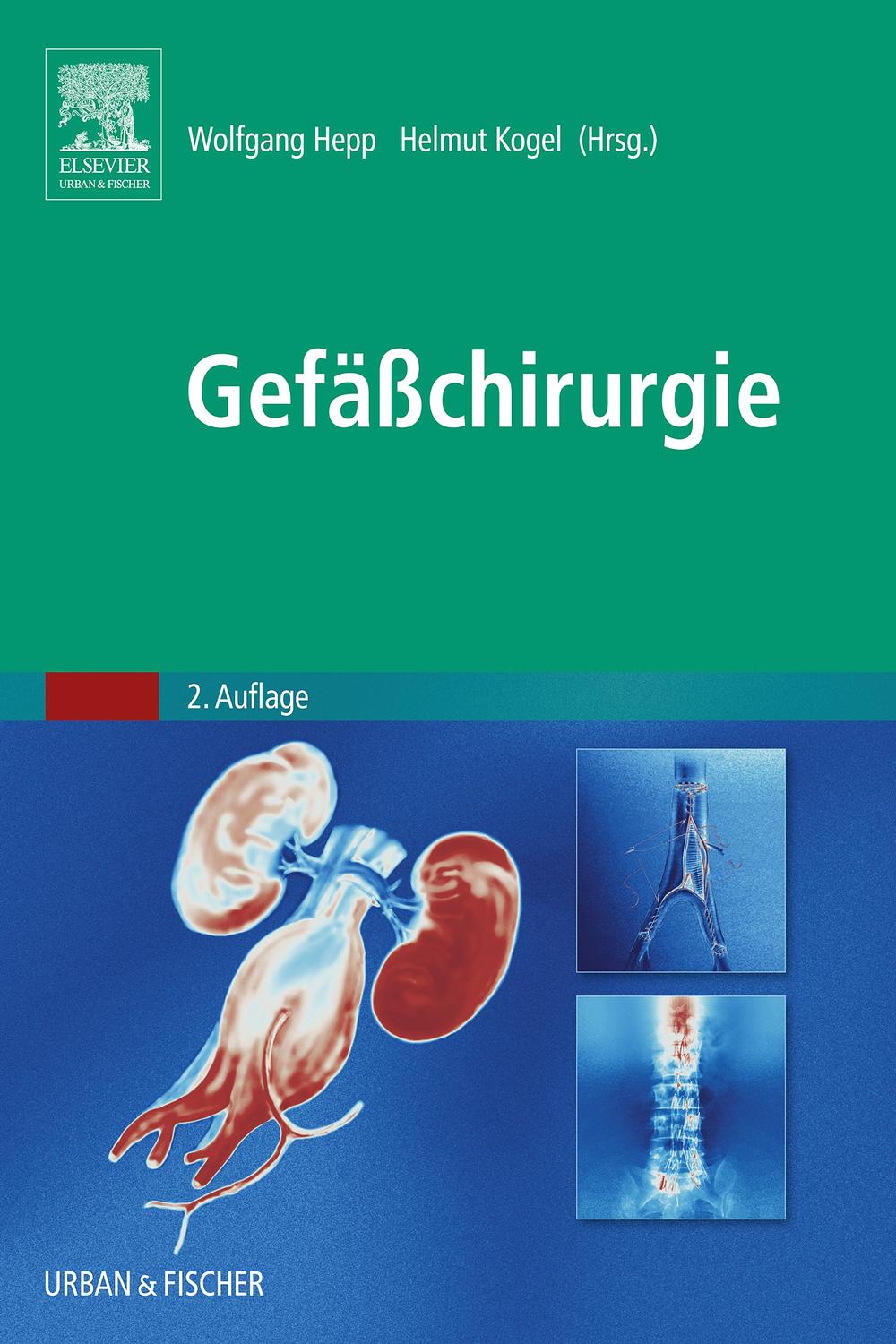 Gefäßchirurgie - Wolfgang Hepp, Helmut Kogel