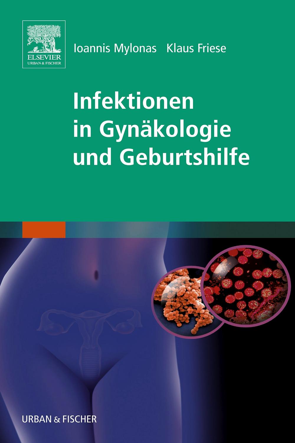 Infektionen in Gynäkologie und Geburtshilfe - Ioannis Mylonas, Klaus Friese