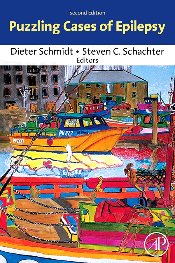 Puzzling Cases of Epilepsy - Dieter Schmidt, Steven C. Schachter