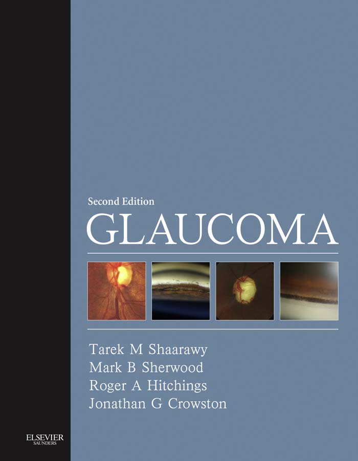 Glaucoma E-Book - Tarek M. Shaarawy, Mark B. Sherwood, Roger A. Hitchings, Jonathan G. Crowston