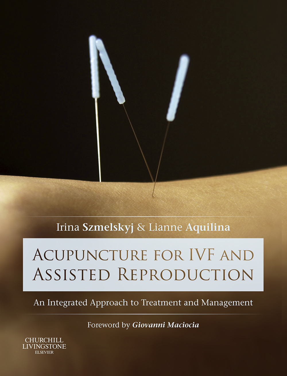 Acupuncture for IVF and Assisted Reproduction - Irina Szmelskyj, Lianne Aquilina, Alan Szmelskyj