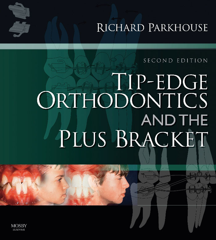 Tip-Edge Orthodontics and the Plus Bracket - Richard Parkhouse