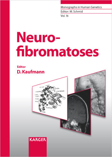 Neurofibromatoses - Schmid, Kaufmann