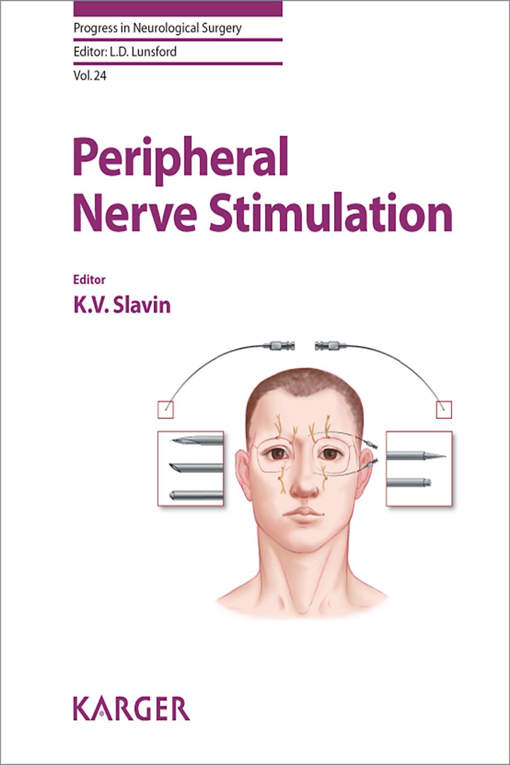 Peripheral Nerve Stimulation - K. V. Slavin