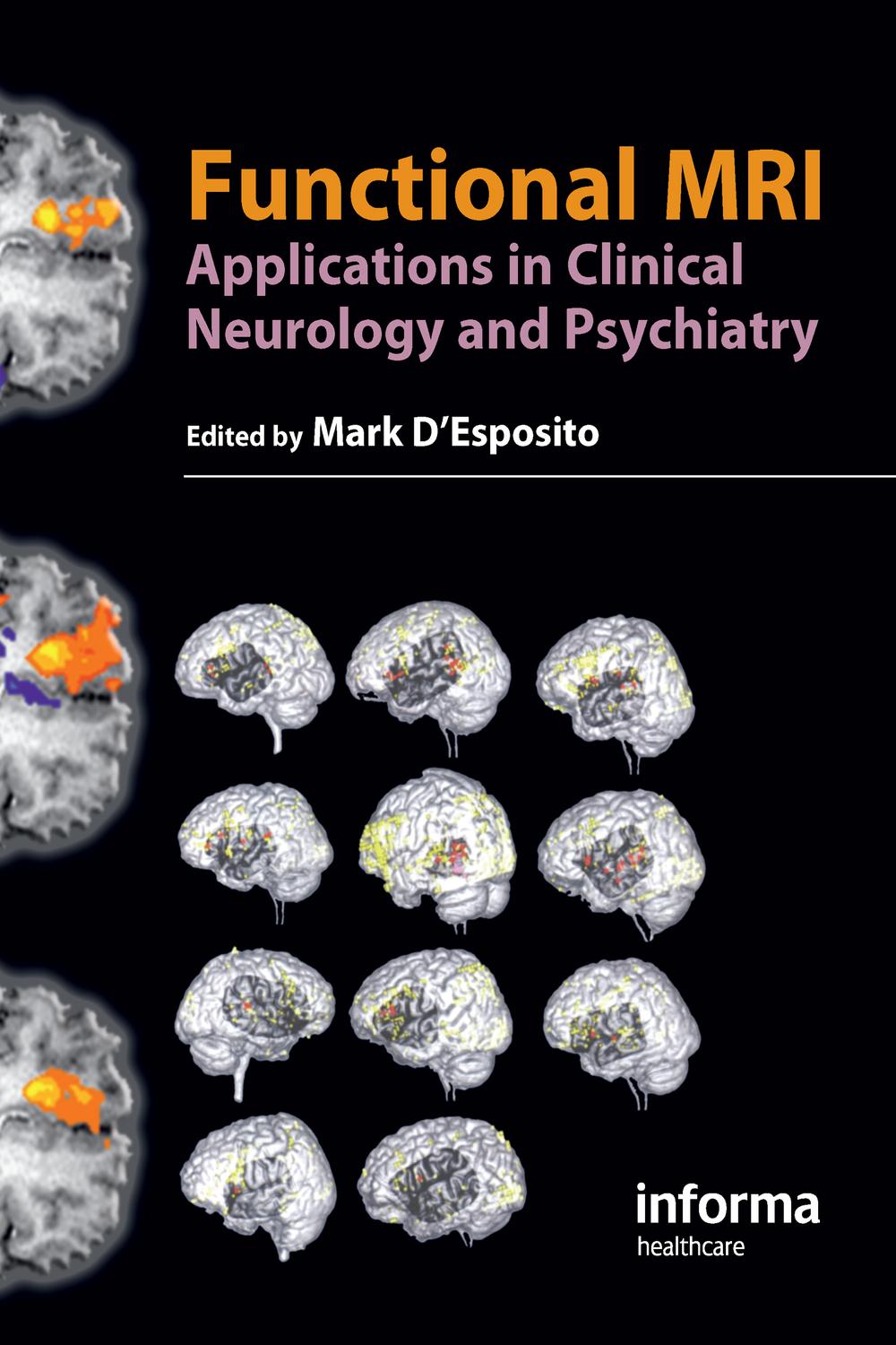 Functional MRI - Mark D'Esposito