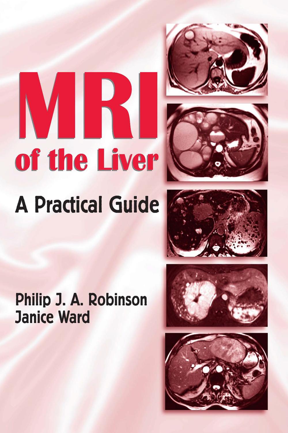 MRI of the Liver - Philip J. A. Robinson, Janice Ward