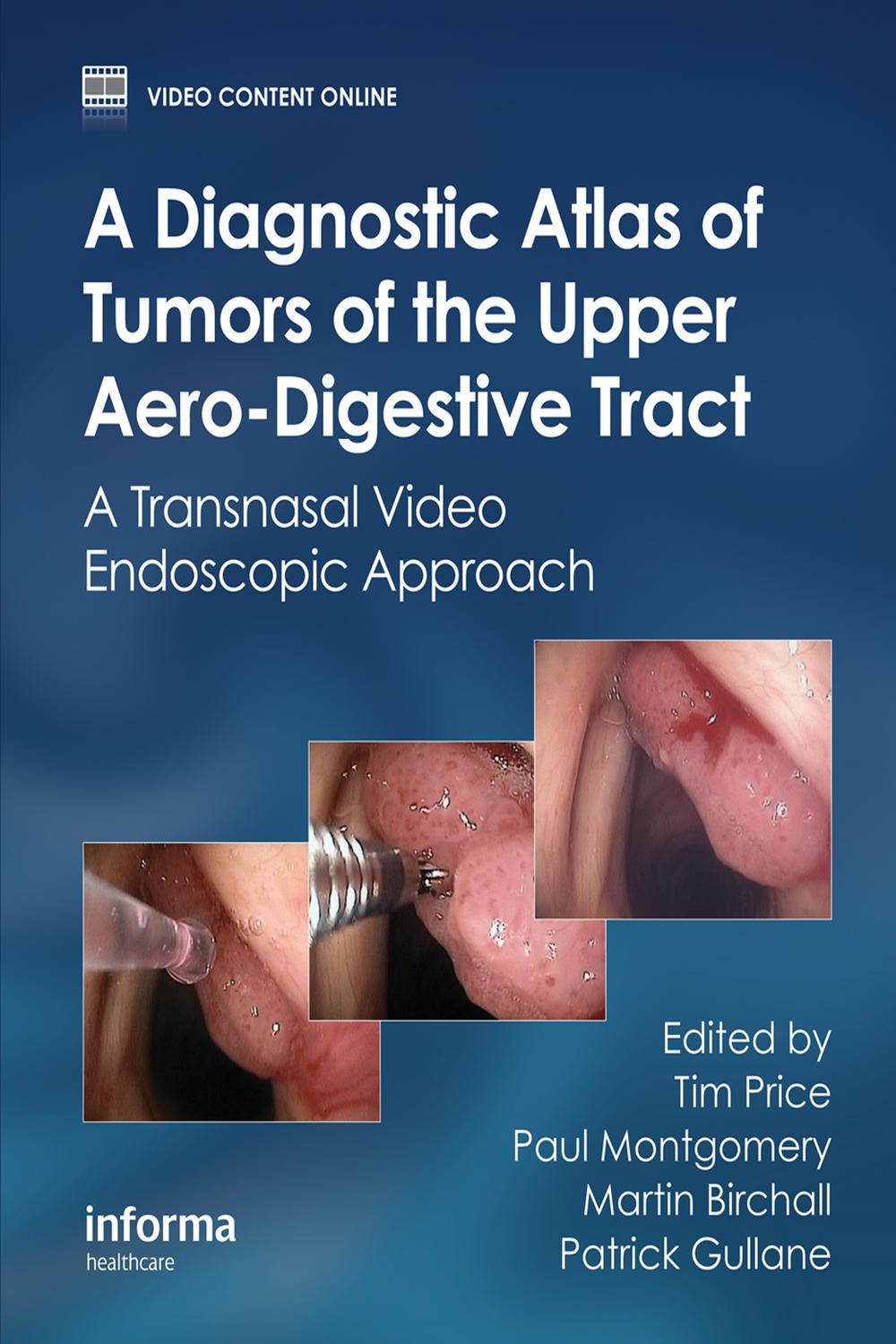 A Diagnostic Atlas of Tumors of the Upper Aero-Digestive Tract - Tim Price, Paul Montgomery, Martin Birchall, Patrick Gullane