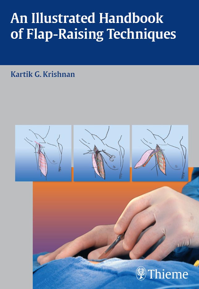 Illustrated Handbook of Flap-Raising Techniques - Kartik G. Krishnan