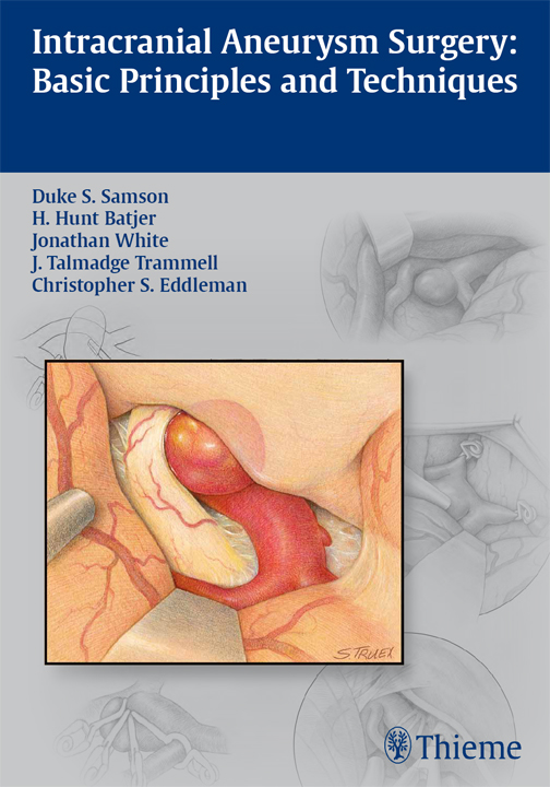 Intracranial Aneurysm Surgery - Duke Samson, H. Hunt Batjer