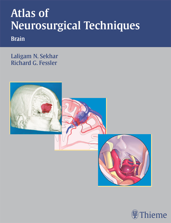 Atlas of Neurosurgical Techniques - Laligam N. Sekhar, Richard Glenn Fessler