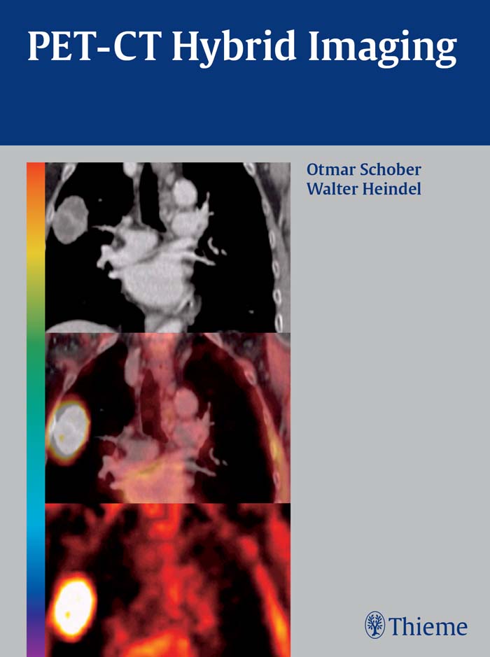 PET-CT Hybrid Imaging - Otmar Schober, Walter Heindel