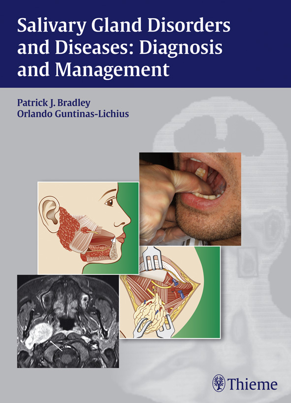 Salivary Gland Disorders and Diseases: Diagnosis and Management - Patrick J. Bradley, Orlando Guntinas-Lichius