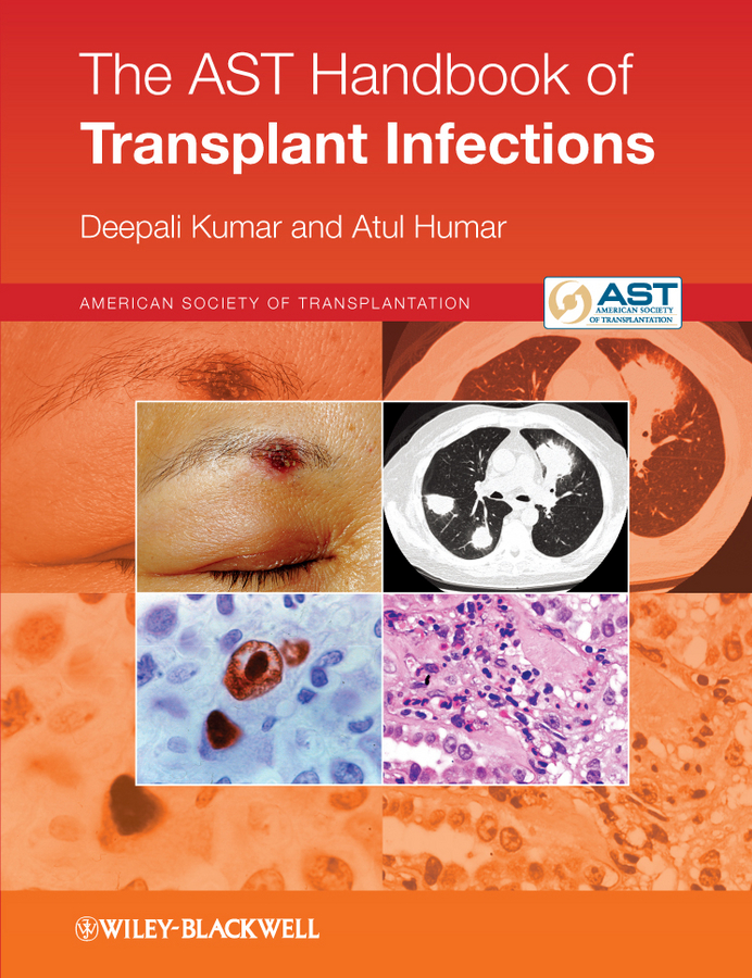The AST Handbook of Transplant Infections - Deepali Kumar, Atul Humar